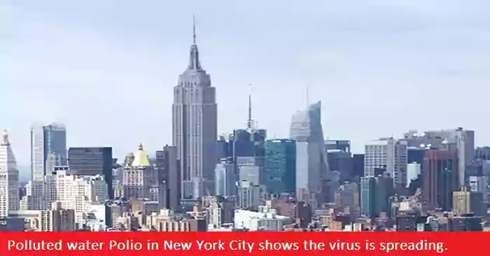 Unclean water New York City's case of polio is proof that the virus is spreading.